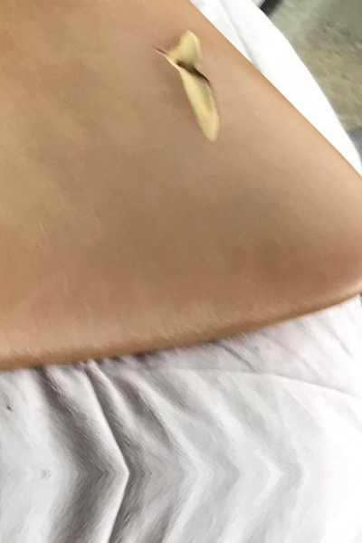 Chair before repair